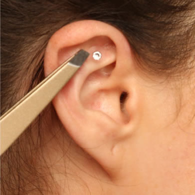 ear-seeds-placement